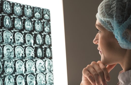 doctor looking at scans